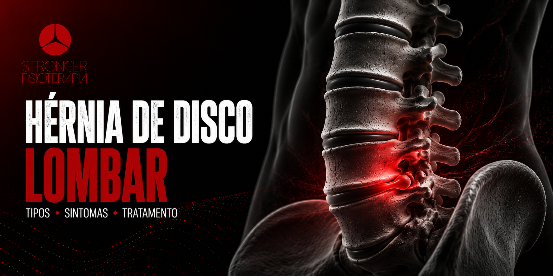 dor lombar, hérnia de disco lombar